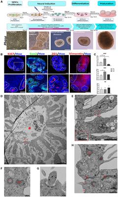 Human cerebral organoids: cellular composition and subcellular morphological features